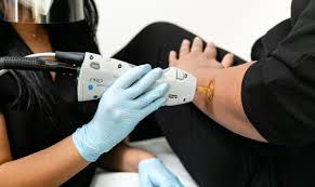 Effortless Beauty Solutions: Laser Hair Removal in San Jose post thumbnail image