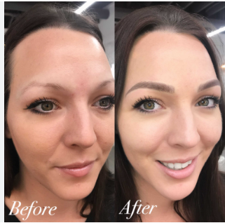 Elevate Your Brows: Microblading in Sandy Springs at Look Natural post thumbnail image
